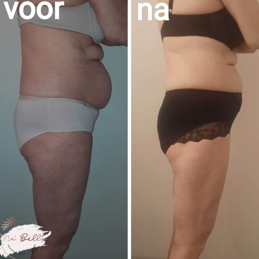 bodysculptor resultaat