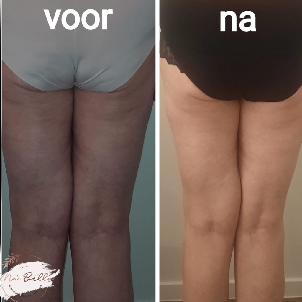 bodysculptor resultaat 3